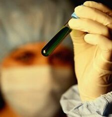 parazitlar uchun qanday sinovdan o'tish kerak