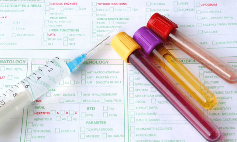 tanadagi parazitlar uchun diagnostika imkoniyatlari