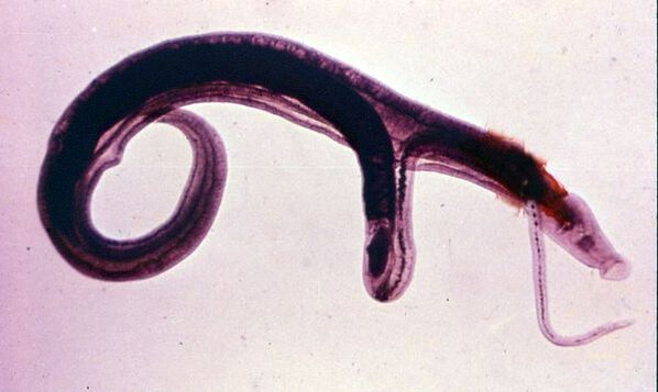 Shistosomalar eng keng tarqalgan va xavfli parazitlardan biridir